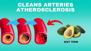 6 Vitamins That Naturally Unclog Your Arteries Atherosclerosis Remedies [upl. by Drisko431]