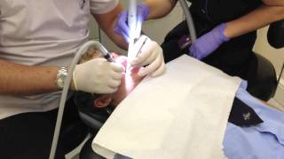 dentist injection drill and filling [upl. by Slen]