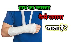 How to Apply POP COST FOR WRIST JOINT [upl. by Alyose]