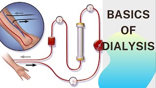 Basic concept of Dialysis Machine  Fresenius 4008S  Dialyzer amp Dialysate Function [upl. by Lecroy795]