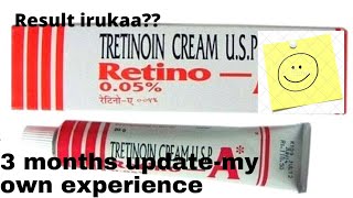 tretinoin cream usesbenefits and side effects in tamil  honest review  my 3 month update [upl. by Lenrow]