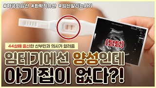 임신 확인 방법 총정리🔥｜착상 실패 자궁외임신 😱｜임밍아웃 시기 추천해드립니다  노노산부인과 ep40 [upl. by Einad]