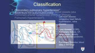 Pulmonary Hypertension A challenging cause of shortness of breath [upl. by Yggep]