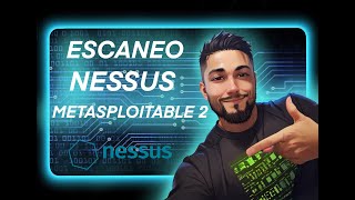 💡DESCARGA amp INSTALACIÓN  🔵 ESCANEO DE VULNERABILIDADES NESSUS  🔴 METASPLOITABLE 2  2024 [upl. by Yenahteb]