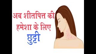 अब शीतपित्त की हमेशा के लिए छुट्टी II Urticaria Treatment  Dr Parmeshwar Arora [upl. by Osanna]