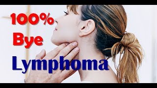 How To Cure Lymphoma Symptoms And Treatment Of Lymphoma [upl. by Ydaj]