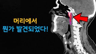 과학자들은 우리의 머리에서 지금까지 몰랐던 새로운 기관을 발견했습니다 [upl. by Notle474]