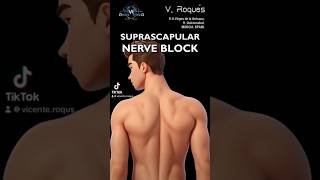 SUPRASCAPULAR NERVE BLOCK nerveblock nervepainrelief nerveblocks nervepaintreatment [upl. by Atel]