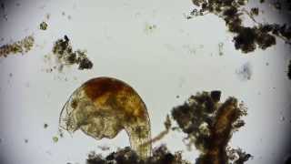 Mikroorganismus  microorganism  microorganisms under microscope in 1080p Full HD [upl. by Yhtimit]