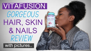 VITAFUSION HAIR SKIN AND NAILS GUMMIES REVIEW｜SHELETHIA TRENAE [upl. by Eiroc415]