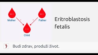 Eritroblastosis fetalis [upl. by Einal]