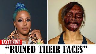 20 Black celebrities Who RUINED Their Careers With PLASTIC SURGERY [upl. by Heilner]