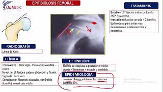 5 RM18 1V TRAUMATOLOG A D A 3 EPIFISIOLISIS FEMORAL [upl. by Gnoc320]