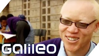 Albinos in Afrika  Galileo  ProSieben [upl. by Yramliw754]