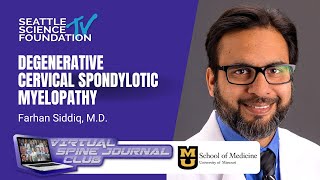 Degenerative Cervical Spondylotic Myelopathy  Farhan Siddiq MD amp Mizzou Neurosurgery [upl. by Hatfield]