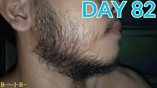 DAY 82  KIRKLAND MINOXIDIL BEARD JOURNEY [upl. by Leirej]