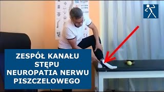 Ból stopy po stronie przyśrodkowej  Kanał stępu  Neuropatia nerwu piszczelowego  Ćwiczenia I 🇵🇱🇪🇺 [upl. by Brander889]