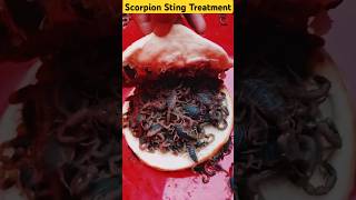 Scorpion Sting Treatment 🦂 bollywood newsong music facts knowledge shorts [upl. by Dalohcin]