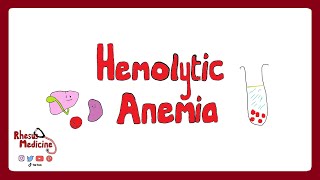 HEMOLYTIC ANEMIA Extravascular v Intravascular Clinical Features Diagnosis Coombs Test  Rhesus [upl. by Lawler]