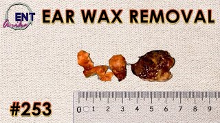 We Tested Ridiculous Ear Wax Removal Methods [upl. by Vinson]