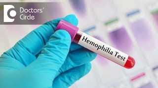 Dental management of patients with Hemophilia  Dr Aniruddha KB [upl. by Rosane523]