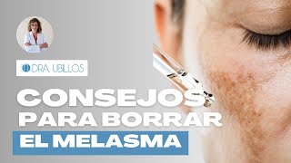 CONSEJOS PARA BORRAR EL MELASMA [upl. by Coray]