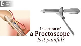 Purpose of proctoscopy How will a doctor insert a Proctoscope  Dr Rajasekhar M R [upl. by Asyen591]