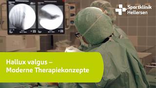 Hallux valgus – Moderne Therapiekonzepte [upl. by Sapienza607]