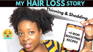 My Hair Loss Story  Iron deficiency Anemia amp 5 Iron BOOSTING recipes Low Iron [upl. by Evilc]