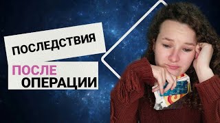 Осложнения после удаления щитовидки  диффузно токсический зоб гипертиреоз [upl. by Nonah]