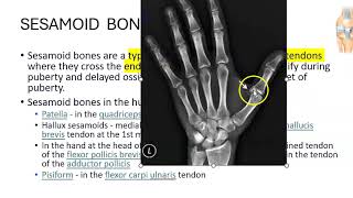 Anatomy 201 Sesamoid Bone Patella Pisiform Carpal bones Define Solved Question Paper [upl. by Louisa90]