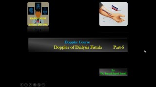 Doppler of Dialysis Fistula Part 6  Flow Volume Measurement [upl. by Ardy863]