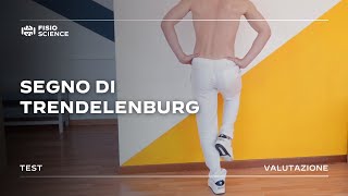 Segno di Trendelenburg  Valutazione abduttori danca [upl. by Erme]