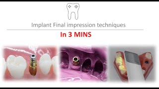 Implant impression techniques in 3 mins  closed tray  open tray scan [upl. by Converse]