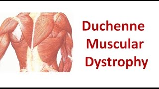 Duchenne Muscular Dystrophy [upl. by Felten]