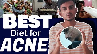 Full day diet to remove Acne amp Pimples Hindi  Remove acne in 30 days  TIRTH 🔥 [upl. by Ellehsor306]