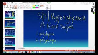 signs and symptoms of hyperglycemia EXPLAINED [upl. by Garald]