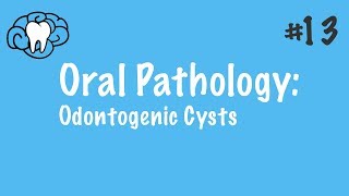 Oral Pathology  Odontogenic Cysts  INBDE ADAT [upl. by Sedgewick]