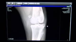 Dog with Torn ACL in Left Knee  High Desert Veterinary [upl. by Wilhelmina]