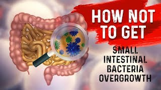 How to STOP Small Intestine Bacterial OvergrowthSIBO – Dr Berg [upl. by Dolph417]