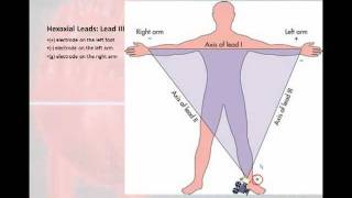 12 Lead Interpretation Part 1 Introduction to the 12 Lead EKG [upl. by Weathers]