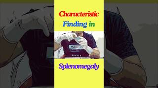 What is the characteristic finding in splenomegaly shorts spleen splenomegaly anatomy [upl. by Maxma]