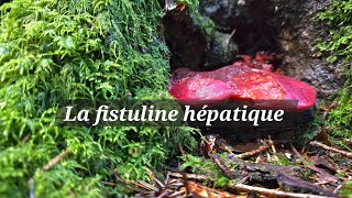 La fistuline hépatique [upl. by Orapma]