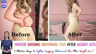 7 Effective Ways to Tighten Sagging Abdominal Skin After Weight Loss skincare tightenskin weight [upl. by Kamilah]