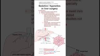 Sedative  hypnotics in liver surgery [upl. by Ynittirb626]