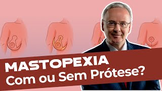 Tudo sobre Mastopexia com ou sem prótese [upl. by Rhines99]