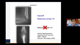 FRACTURAS DE MIEMBRO SUPERIOR EN NIÑOS II DR CONGIN 2023 [upl. by Haimirej]