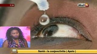 SANTE la conjonctivite Apolo dans Petit Dej du 07 nov 2016 avec Amina [upl. by Towers]