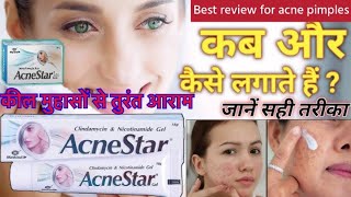 Acnestar gel for acne pimples कील मुंहासों से तुरंत आराम असरदार दवाई youtubeviralvideo ytvideo [upl. by Neehs789]