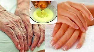 It will remove your hands and finger wrinkles keep your hands younger [upl. by Ahtibat]